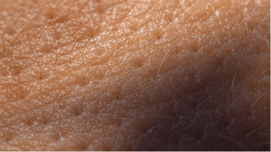 dark skin patch on skin due to insulin resistance