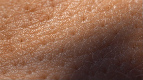 dark skin patch on skin due to insulin resistance